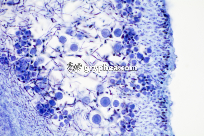 Lichen CT du thalle montrant la symbiose mycelium-algues - gryphea.org